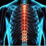 “Implante de médula espinal en Israel con células del paciente”